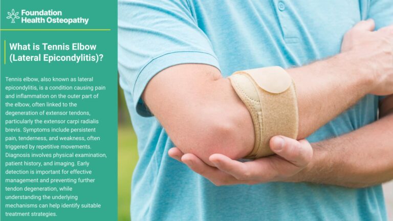 What is tennis elbow -lateral epicondylitis