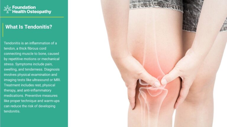 What is tendonitis? Tendonitis is an inflammation of a tendon, a thick fibrous cord connecting muscle to bone, caused by repetitive motions or mechanical stress. Symptoms include pain, swelling, and tenderness. Diagnosis involves physical examination and imaging tests like ultrasound or MRI. Treatment includes rest, physical therapy, and anti-inflammatory medications. Preventive measures like proper technique and warm-ups can reduce the risk of developing tendonitis.