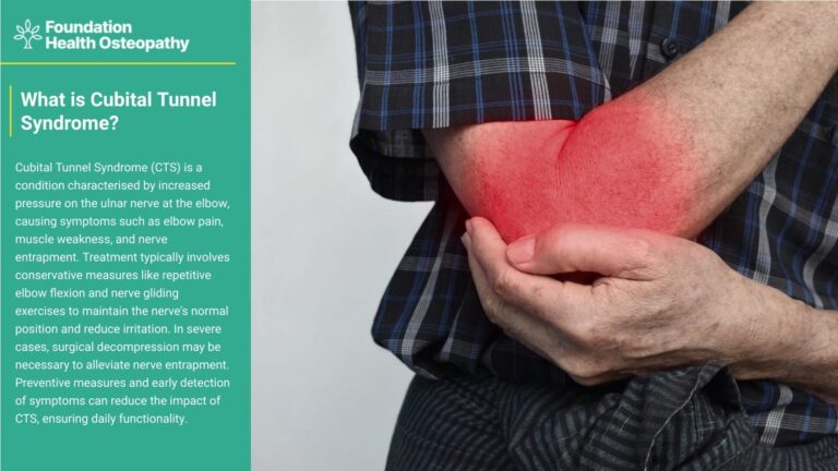 What is cubital tunnel syndrome