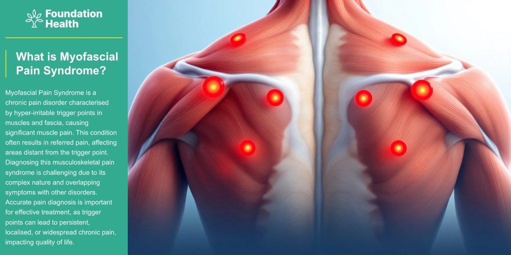 Myofascial pain syndrome | Foundation Health Osteopathy | (02