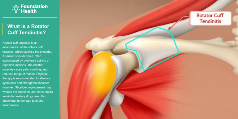 Whats is rotator cuff tendinitis