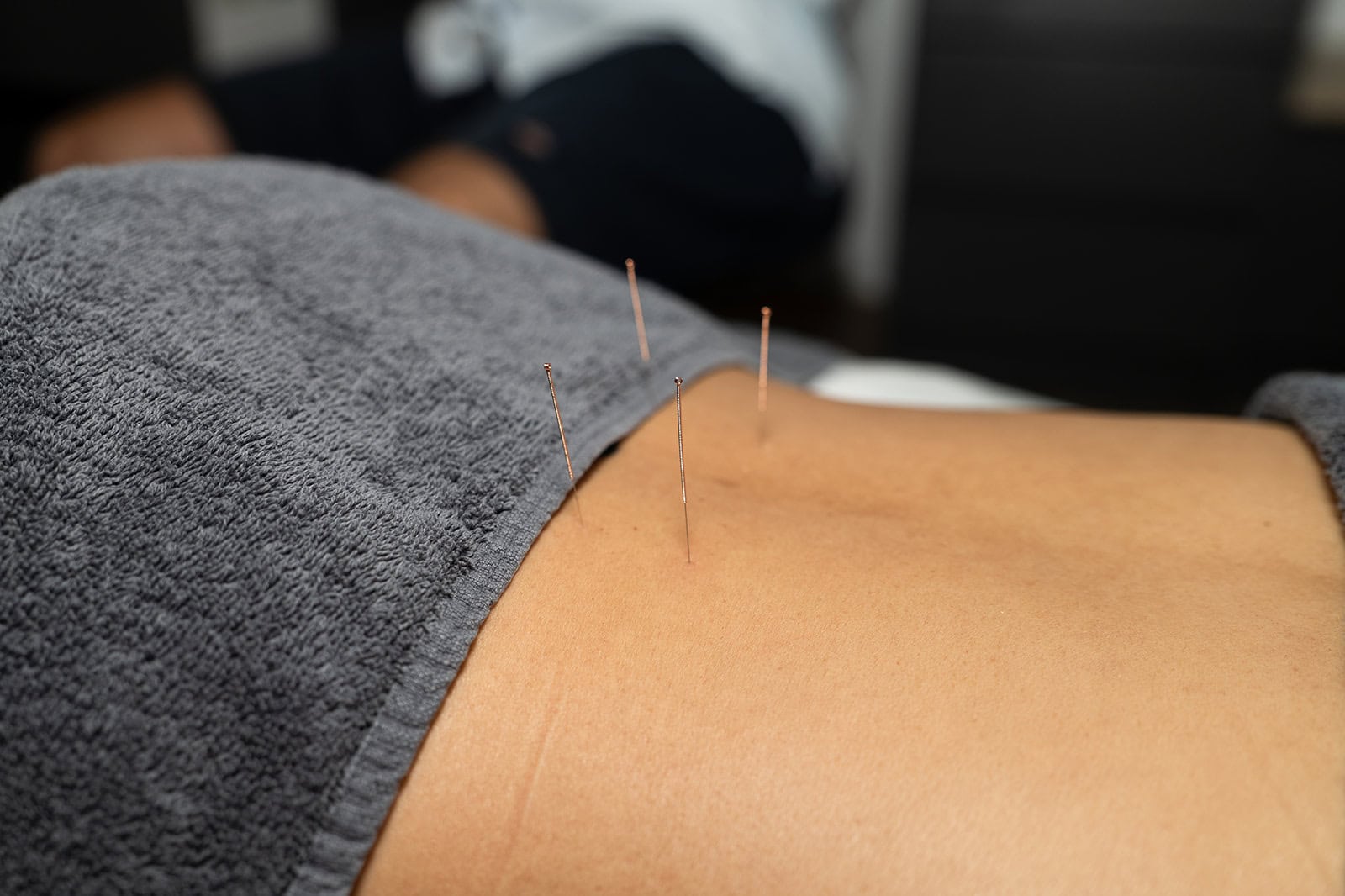 Acupuncture-treatment-for-pain-relief