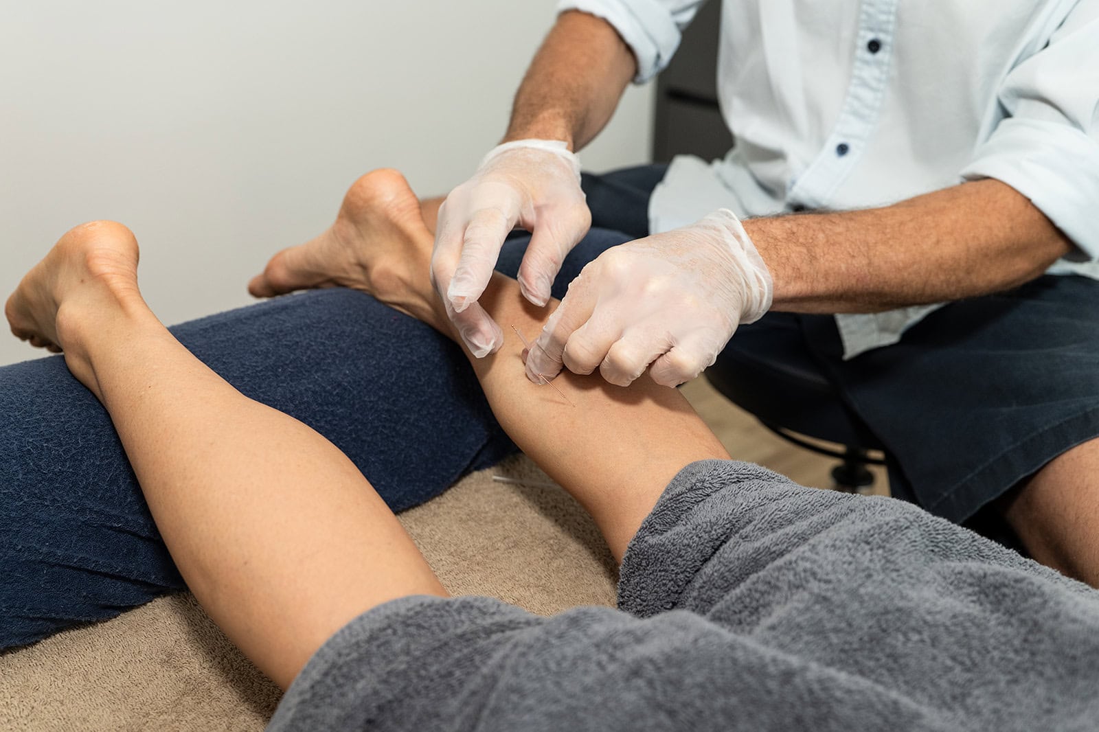 Acupuncture-treatment